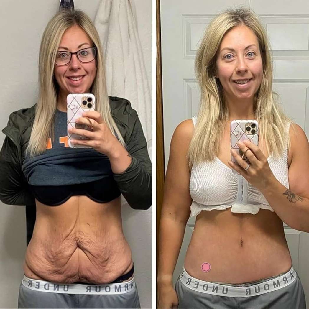 Tu Cuerpo, Tus Reglas - GLP-1 Loecare™ (30 Parches)