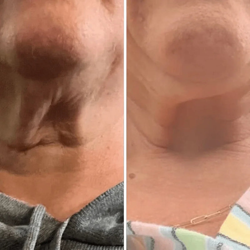 Resultado antes y después 1