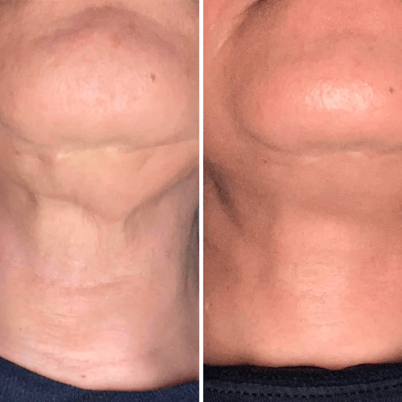 Resultado antes y después 3