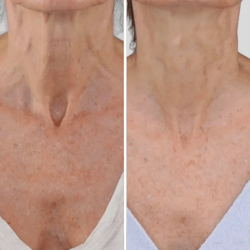 Resultado antes y después 4