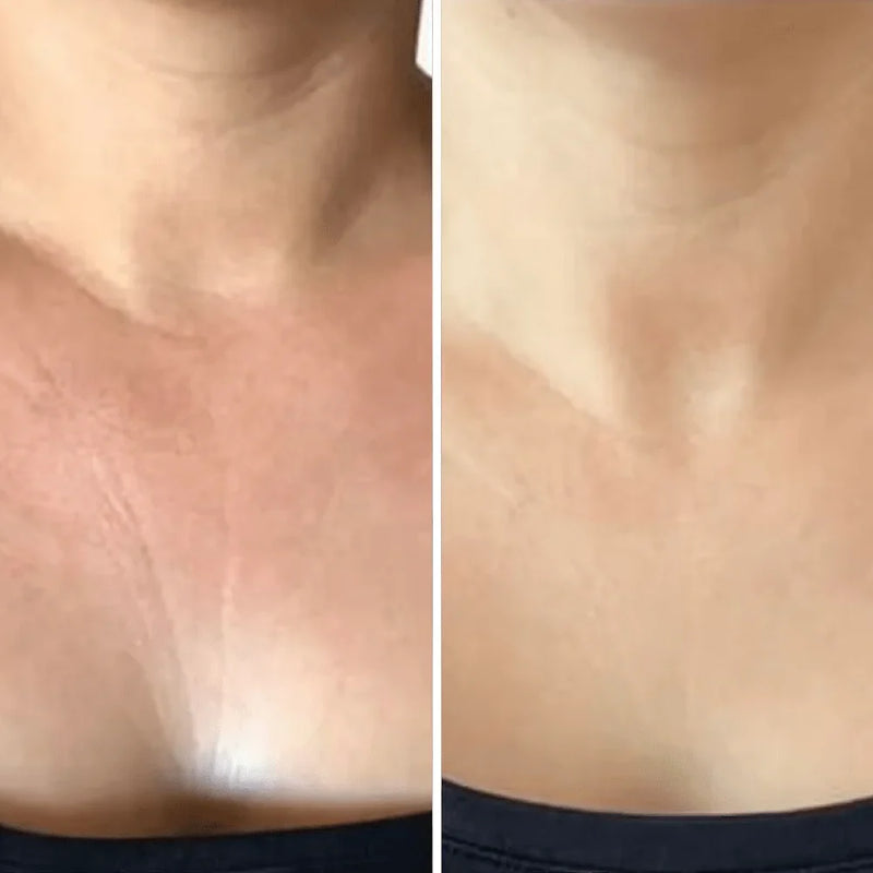 Resultado antes y después 5